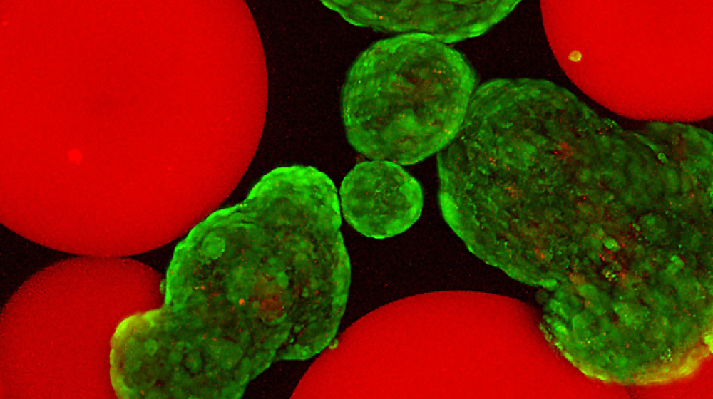 Islets (stained green with viability stain) mixed with microgels presenting FasL (red).